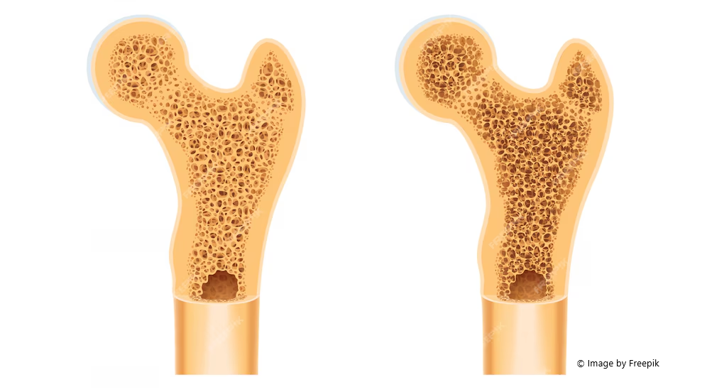 bone